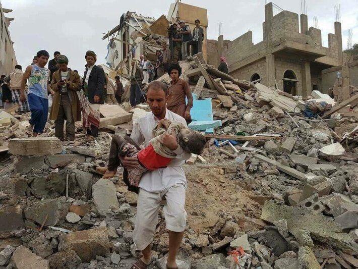خبرنگاران ائتلاف سعودی منکر کودک کشی در یمن شد